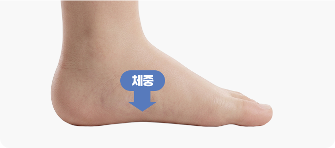 유연성 평발 관련 이미지